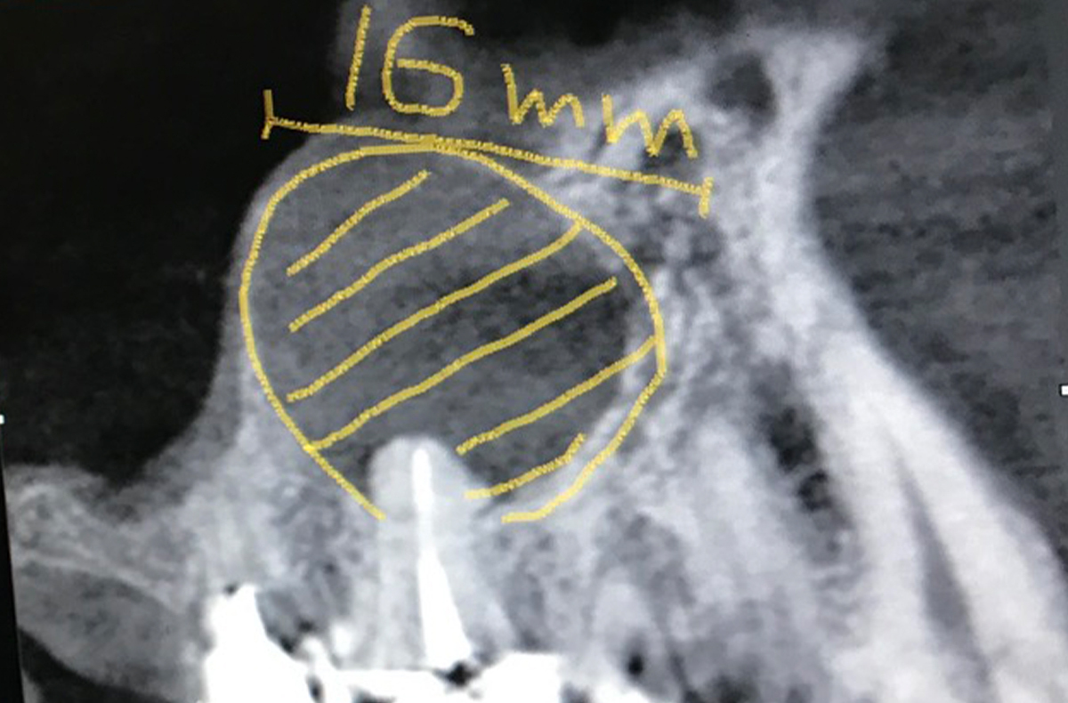 CT撮影による画像診断