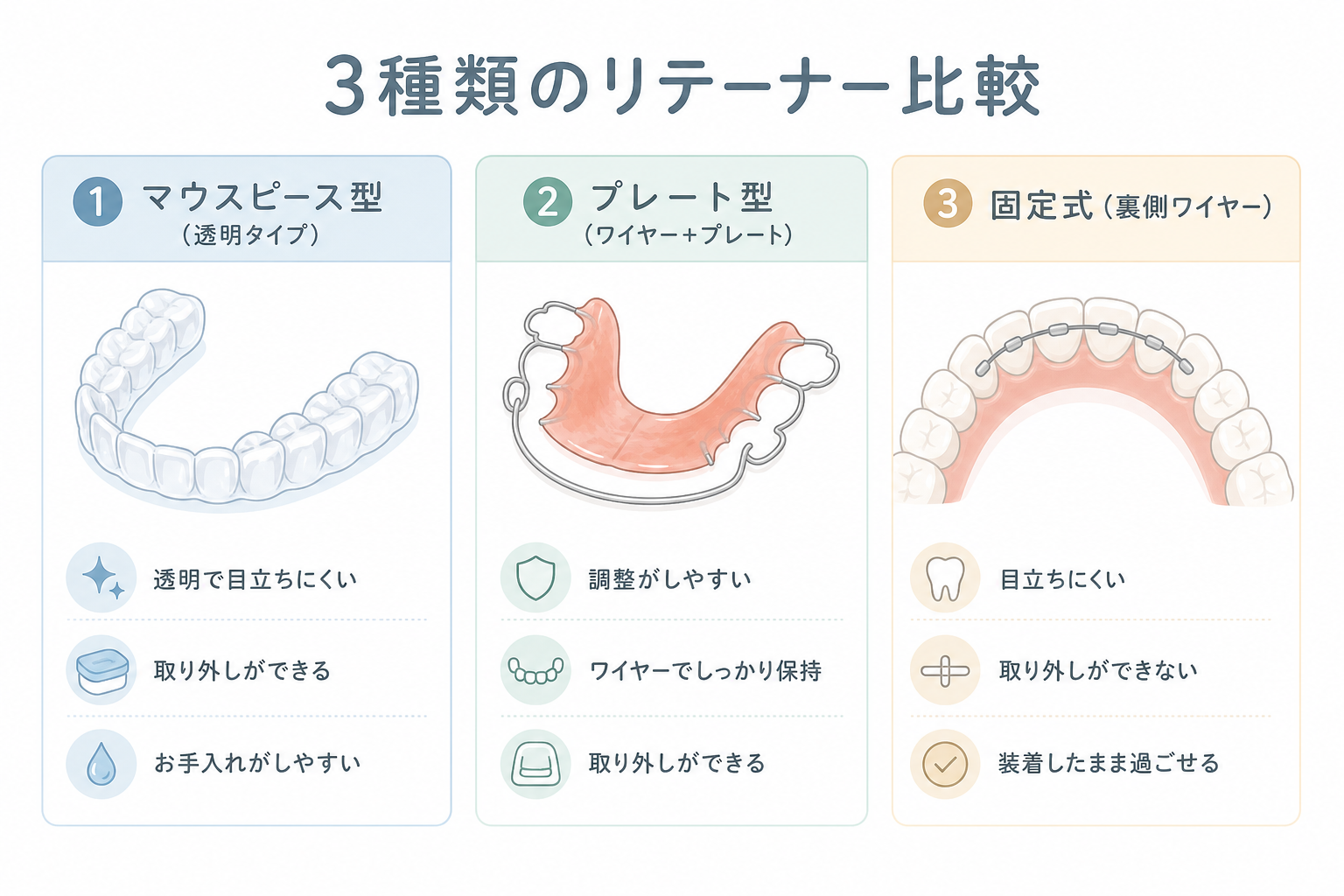 3種類のリテーナー（マウスピース型・プレート型・固定式）の形状を並べた比較イラスト